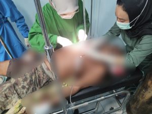 Merasa Telah Diguna-Guna, Yudhi Warga Katingan Tebas Korban Hingga Luka Parah