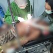FOTO : Korban Ishak mengalami luka parah serta mendapatkan perawatan di RS Pratama Tumbang Samba.