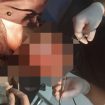 FOTO : Kondisi Korban saat mendapatkan perawatan medis, usai mendapat penganiayaan dari oknum Kades.