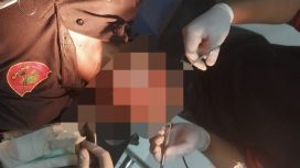 FOTO : Kondisi Korban saat mendapatkan perawatan medis, usai mendapat penganiayaan dari oknum Kades.