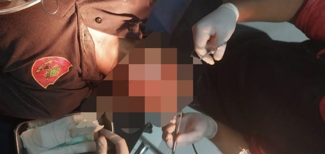 
					FOTO : Kondisi Korban saat mendapatkan perawatan medis, usai mendapat penganiayaan dari oknum Kades.